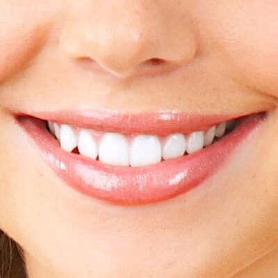 Person smiling with white and straight teeth